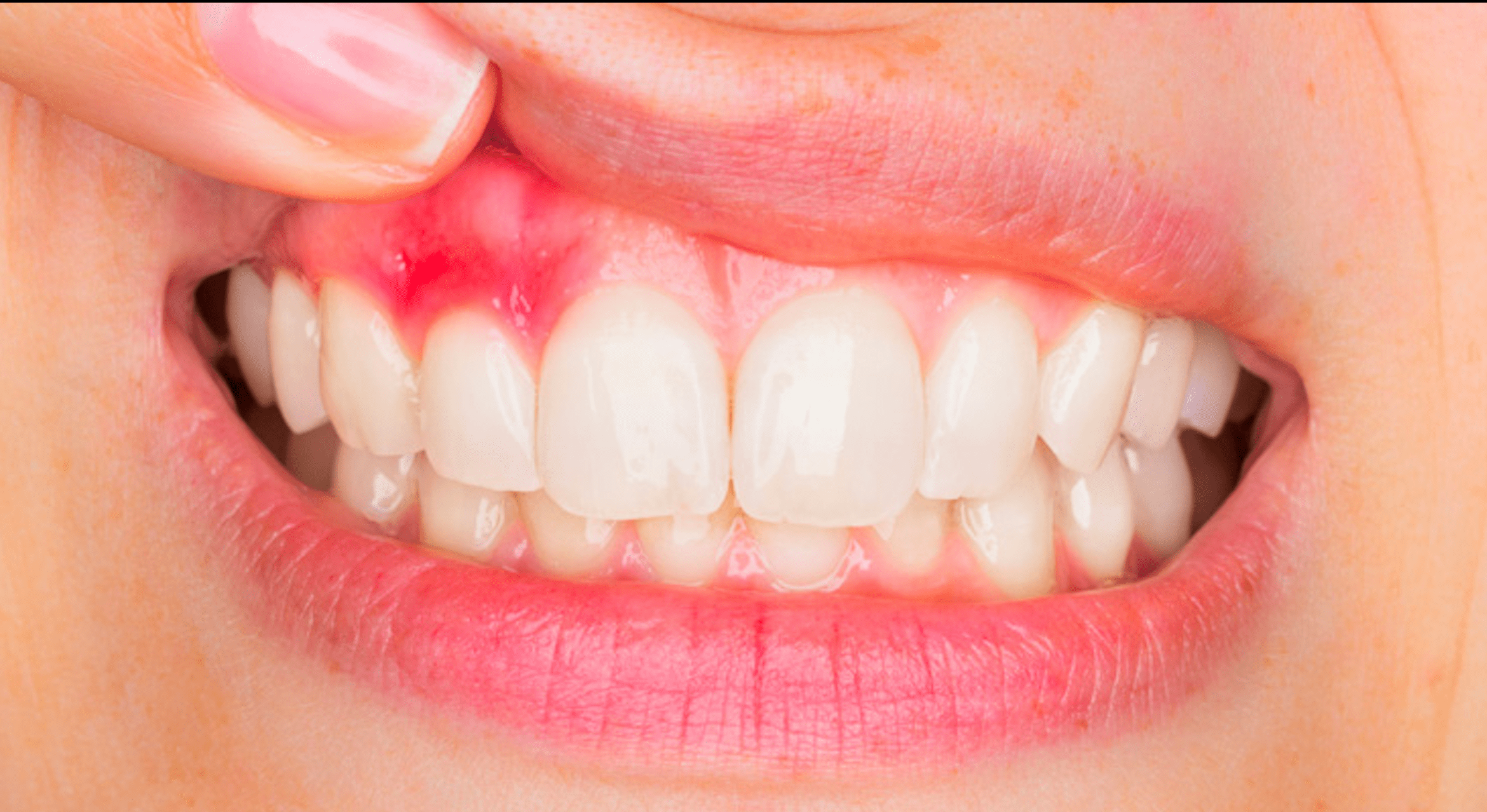 CES de parodontologie